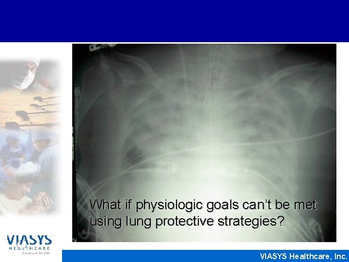 What if physiologic goals can’t be met using lung protective strategies? VIASYS Healthcare, Inc.