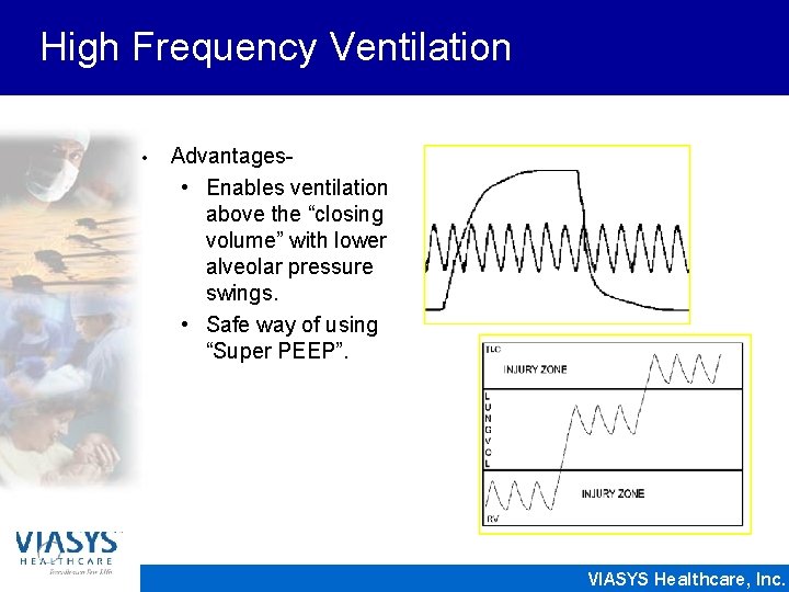 High Frequency Ventilation • Advantages • Enables ventilation above the “closing volume” with lower