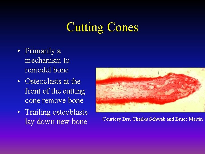 Cutting Cones • Primarily a mechanism to remodel bone • Osteoclasts at the front
