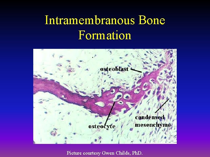 Intramembranous Bone Formation Picture courtesy Gwen Childs, Ph. D. 