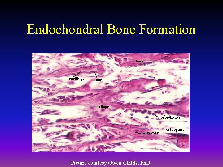 Endochondral Bone Formation Picture courtesy Gwen Childs, Ph. D. 