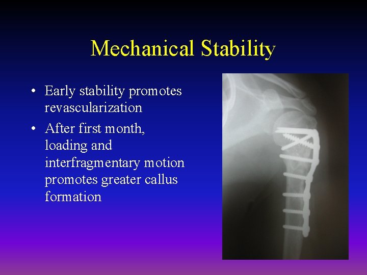 Mechanical Stability • Early stability promotes revascularization • After first month, loading and interfragmentary