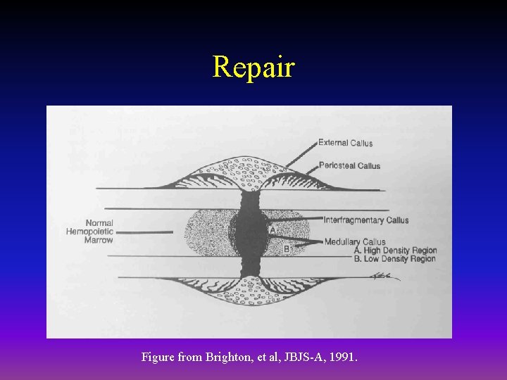 Repair Figure from Brighton, et al, JBJS-A, 1991. 