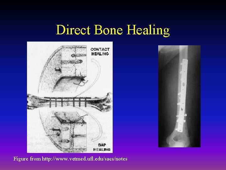 Direct Bone Healing Figure from http: //www. vetmed. ufl. edu/sacs/notes 