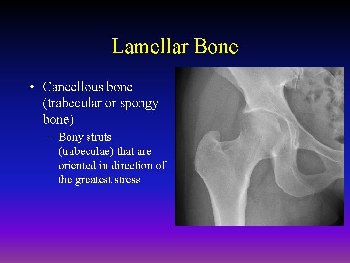 Lamellar Bone • Cancellous bone (trabecular or spongy bone) – Bony struts (trabeculae) that