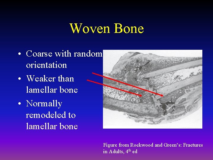 Woven Bone • Coarse with random orientation • Weaker than lamellar bone • Normally