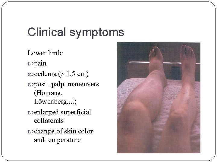 Clinical symptoms Lower limb: pain oedema ( 1, 5 cm) posit. palp. maneuvers (Homans,