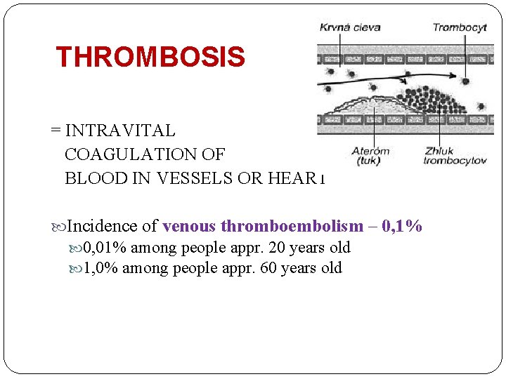 THROMBOSIS = INTRAVITAL COAGULATION OF BLOOD IN VESSELS OR HEART Incidence of venous thromboembolism