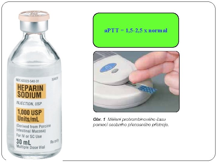 a. PTT = 1, 5 -2, 5 x normal 