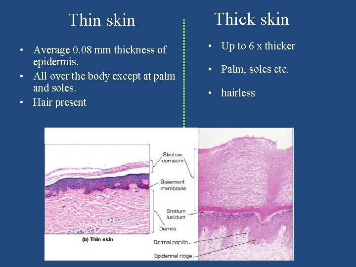 Thin skin • Average 0. 08 mm thickness of epidermis. • All over the