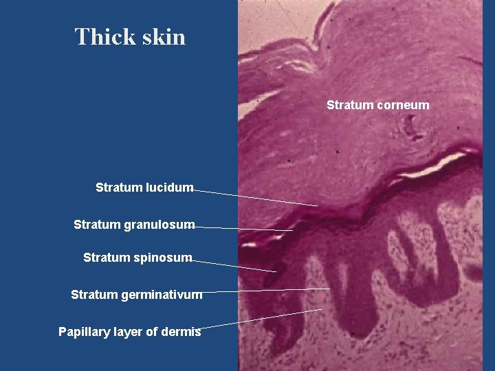 Thick skin Stratum corneum Stratum lucidum Stratum granulosum Stratum spinosum Stratum germinativum Papillary layer