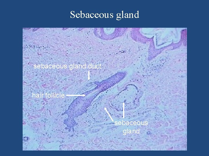 Sebaceous gland sebaceous gland duct hair follicle sebaceous gland 