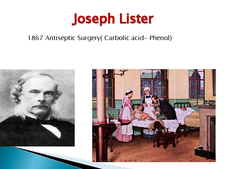 Joseph Lister 1867 Antiseptic Surgery( Carbolic acid- Phenol) 