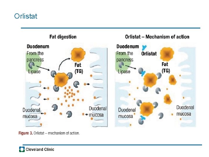 Orlistat 