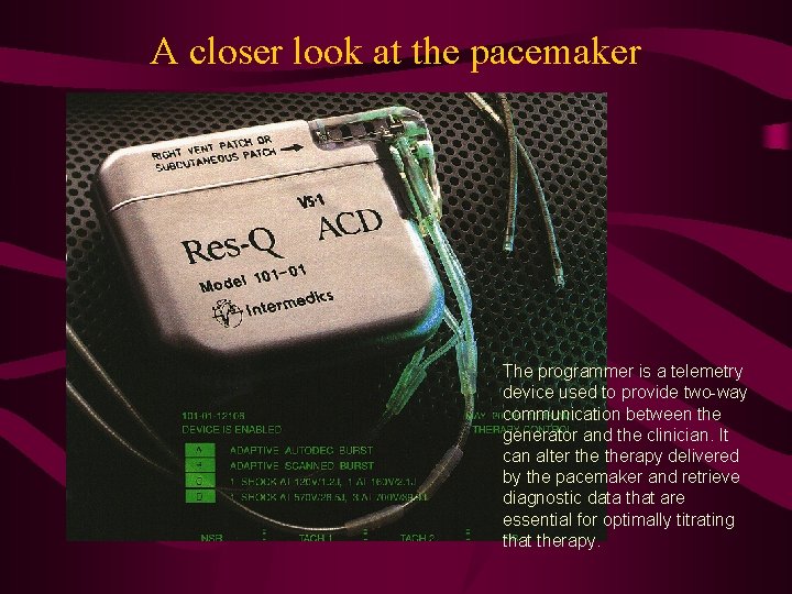 A closer look at the pacemaker The programmer is a telemetry device used to
