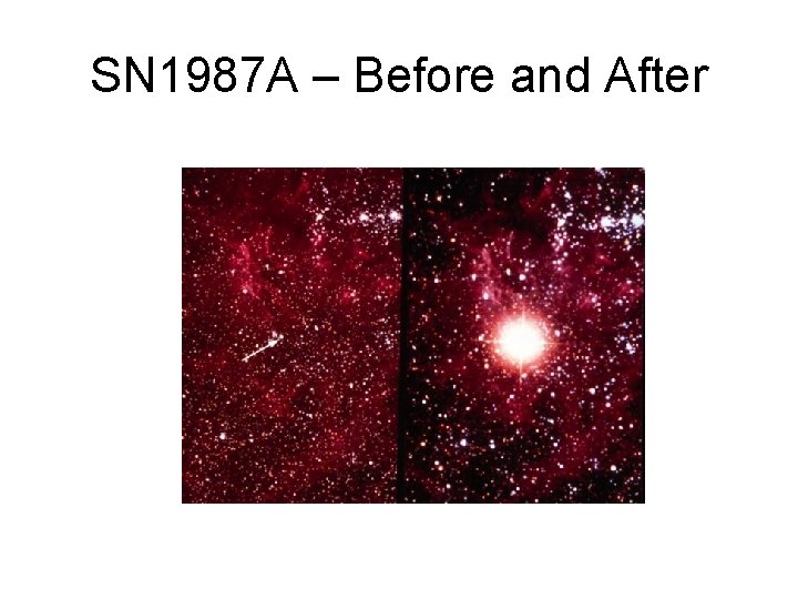 SN 1987 A – Before and After 