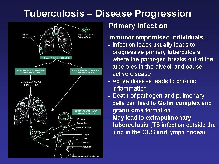 Tuberculosis – Disease Progression Primary Infection Immunocomprimised Individuals… - Infection leads usually leads to