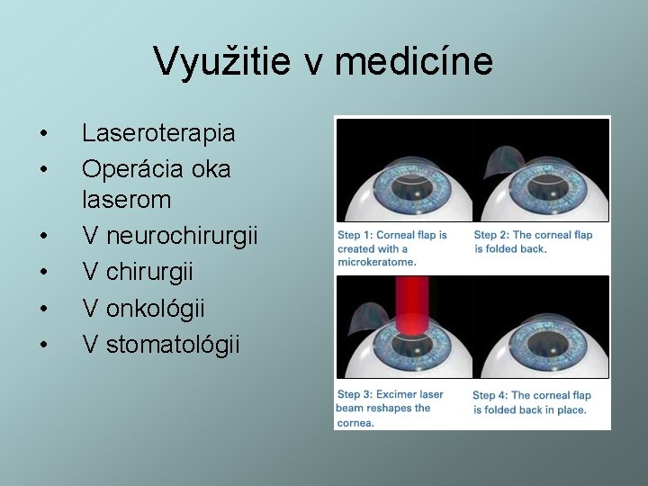 Využitie v medicíne • • • Laseroterapia Operácia oka laserom V neurochirurgii V onkológii