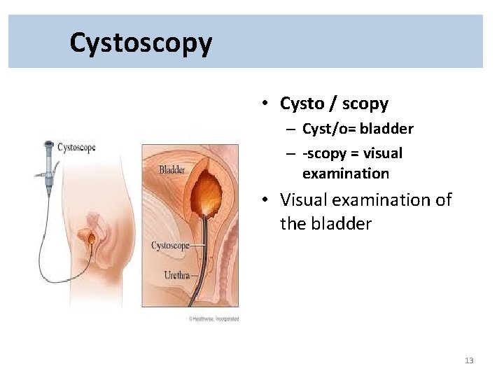 Cystoscopy • Cysto / scopy – Cyst/o= bladder – -scopy = visual examination •
