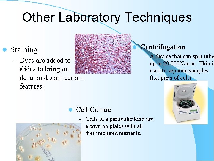 Other Laboratory Techniques l l Staining Centrifugation – A device that can spin tube