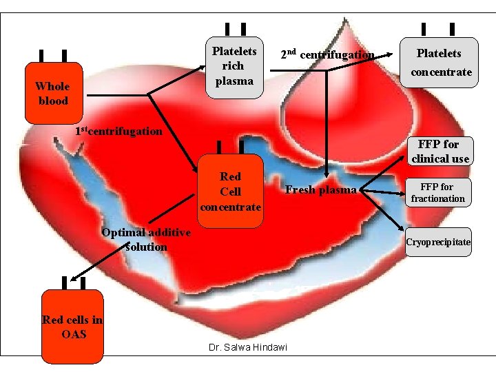 Platelets rich plasma Whole blood 2 nd centrifugation Platelets concentrate 1 stcentrifugation FFP for