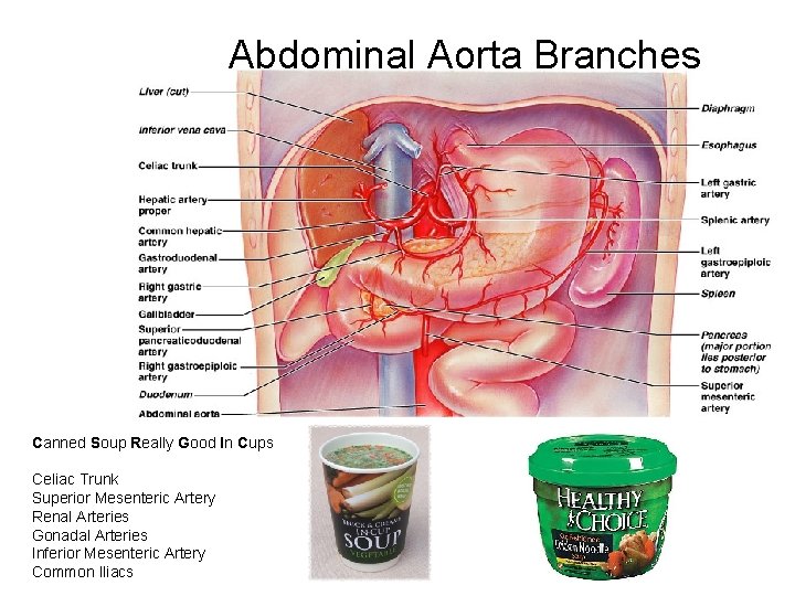 Abdominal Aorta Branches Canned Soup Really Good In Cups Celiac Trunk Superior Mesenteric Artery