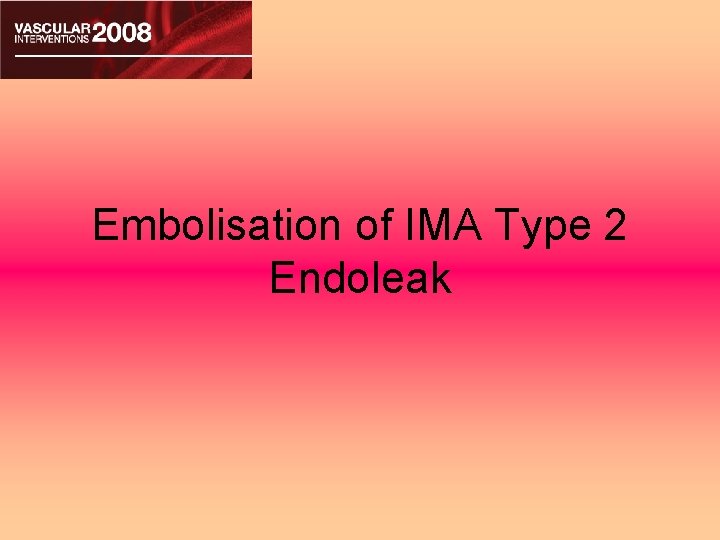 Embolisation of IMA Type 2 Endoleak 