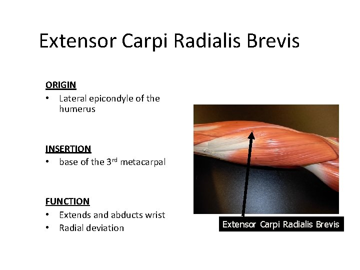 Extensor Carpi Radialis Brevis ORIGIN • Lateral epicondyle of the humerus INSERTION • base