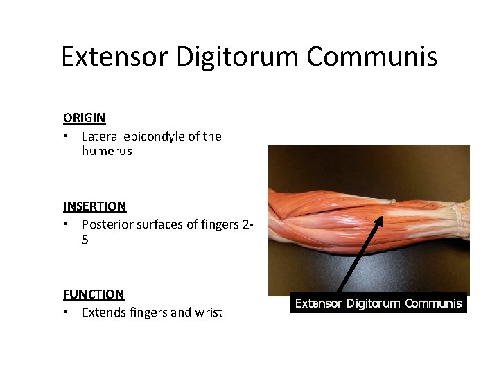 Extensor Digitorum Communis ORIGIN • Lateral epicondyle of the humerus INSERTION • Posterior surfaces