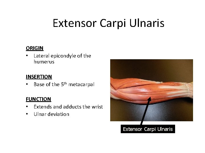 Extensor Carpi Ulnaris ORIGIN • Lateral epicondyle of the humerus INSERTION • Base of