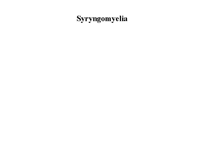 Syryngomyelia 