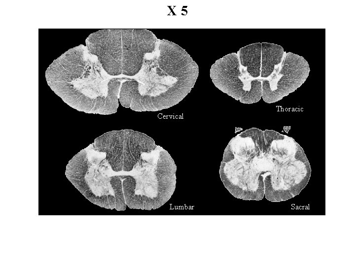 X 5 Cervical Lumbar Thoracic Sacral 