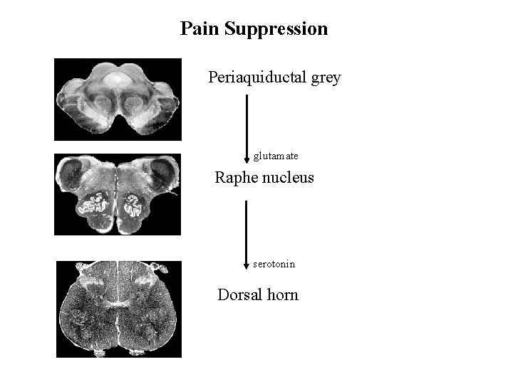 Pain Suppression Periaquiductal grey glutamate Raphe nucleus serotonin Dorsal horn 
