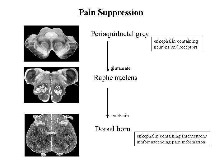 Pain Suppression Periaquiductal grey enkephalin containing neurons and receptors glutamate Raphe nucleus serotonin Dorsal