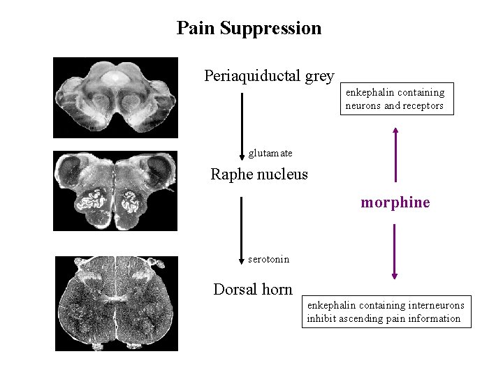 Pain Suppression Periaquiductal grey enkephalin containing neurons and receptors glutamate Raphe nucleus morphine serotonin