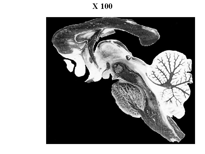 X 100 
