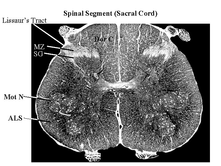 Lissaur’s Tract MZ SG Mot N ALS Spinal Segment (Sacral Cord) Dor C VC
