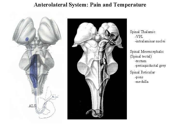 Anterolateral System: Pain and Temperature Spinal Thalamic -VPL -intralaminar nuclei Spinal Mesencephalic (Spinal tectal)