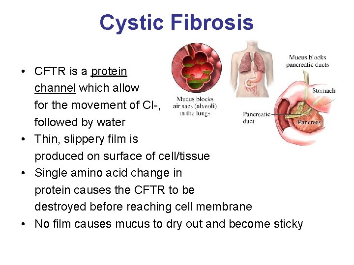 Cystic Fibrosis • CFTR is a protein channel which allow for the movement of