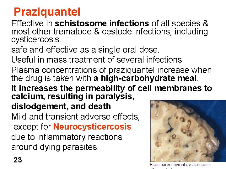 Praziquantel Effective in schistosome infections of all species & most other trematode & cestode