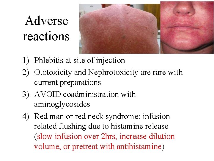 Adverse reactions 1) Phlebitis at site of injection 2) Ototoxicity and Nephrotoxicity are rare