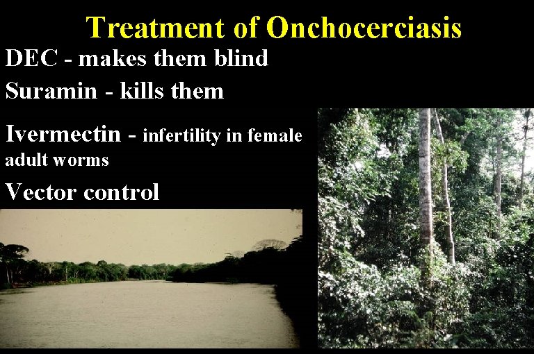 Treatment of Onchocerciasis DEC - makes them blind Suramin - kills them Ivermectin -