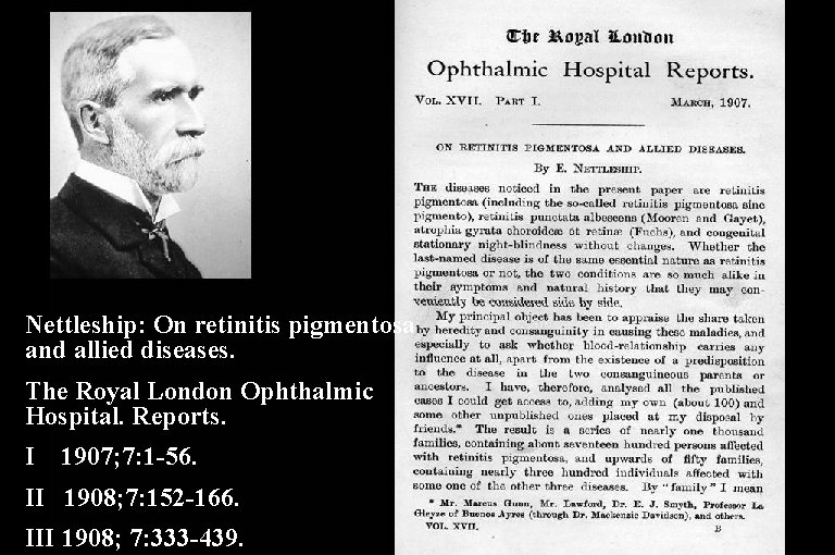 Nettleship: On retinitis pigmentosa and allied diseases. The Royal London Ophthalmic Hospital. Reports. I