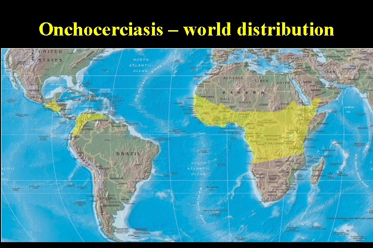 Onchocerciasis – world distribution 