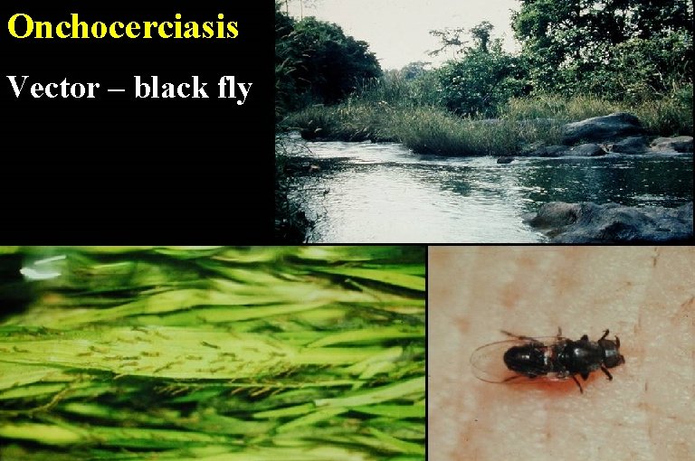 Onchocerciasis Vector – black fly 