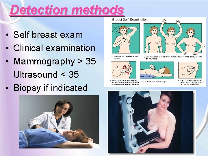 Detection methods • Self breast exam • Clinical examination • Mammography > 35 Ultrasound