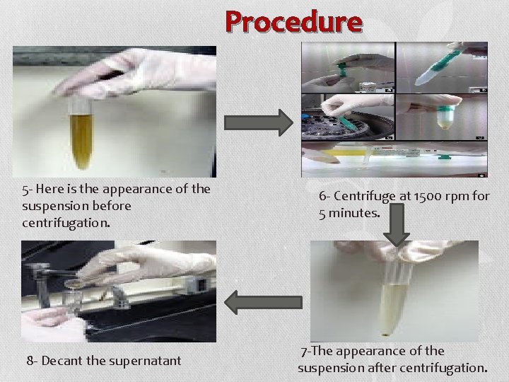 Procedure 5 - Here is the appearance of the suspension before centrifugation. 8 -