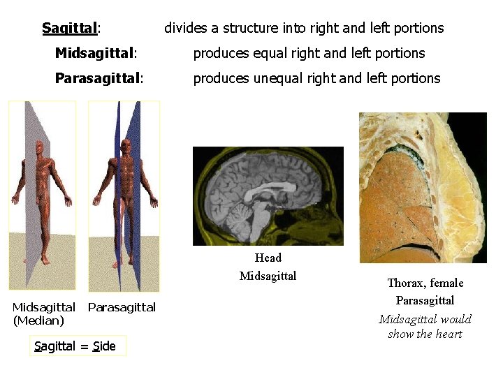 Sagittal: divides a structure into right and left portions Midsagittal: produces equal right and