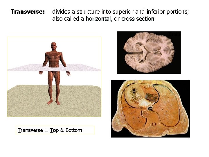 Transverse: divides a structure into superior and inferior portions; also called a horizontal, horizontal