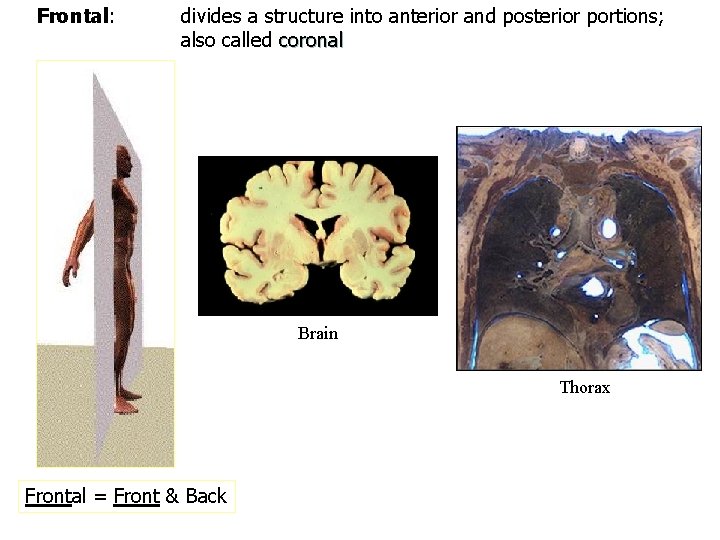 Frontal: divides a structure into anterior and posterior portions; also called coronal Brain Thorax